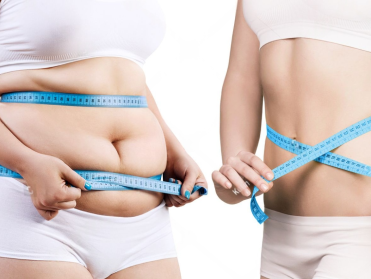 stock-photo-woman-s-body-before-and-after-weight-loss-733085746