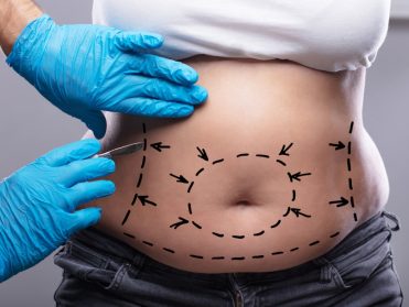 wmremove-transformed (20)